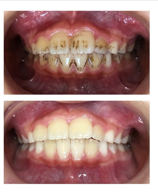 ABUIABACGAAgv4P5lwYo7-KVpwEwzwI46Ac