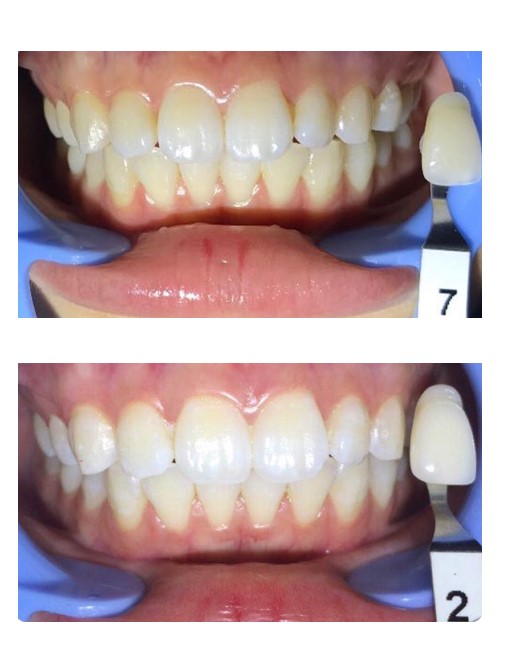 ABUIABACGAAgv4P5lwYo7-KVpwEwzwI46Ac