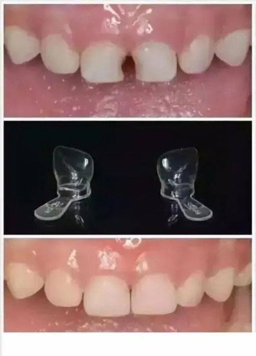 ABUIABACGAAgv4P5lwYo7-KVpwEwzwI46Ac